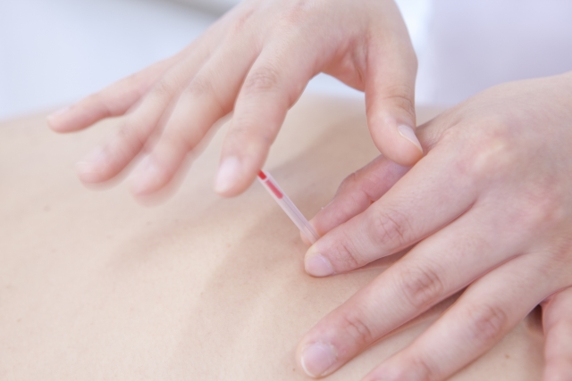 向日市で腰痛を含む慢性の疼痛で悩む方へ~痛みの少ないやさしい施術を提供~