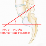 ファーガソンアングル