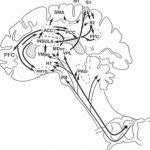 ペインマトリックス